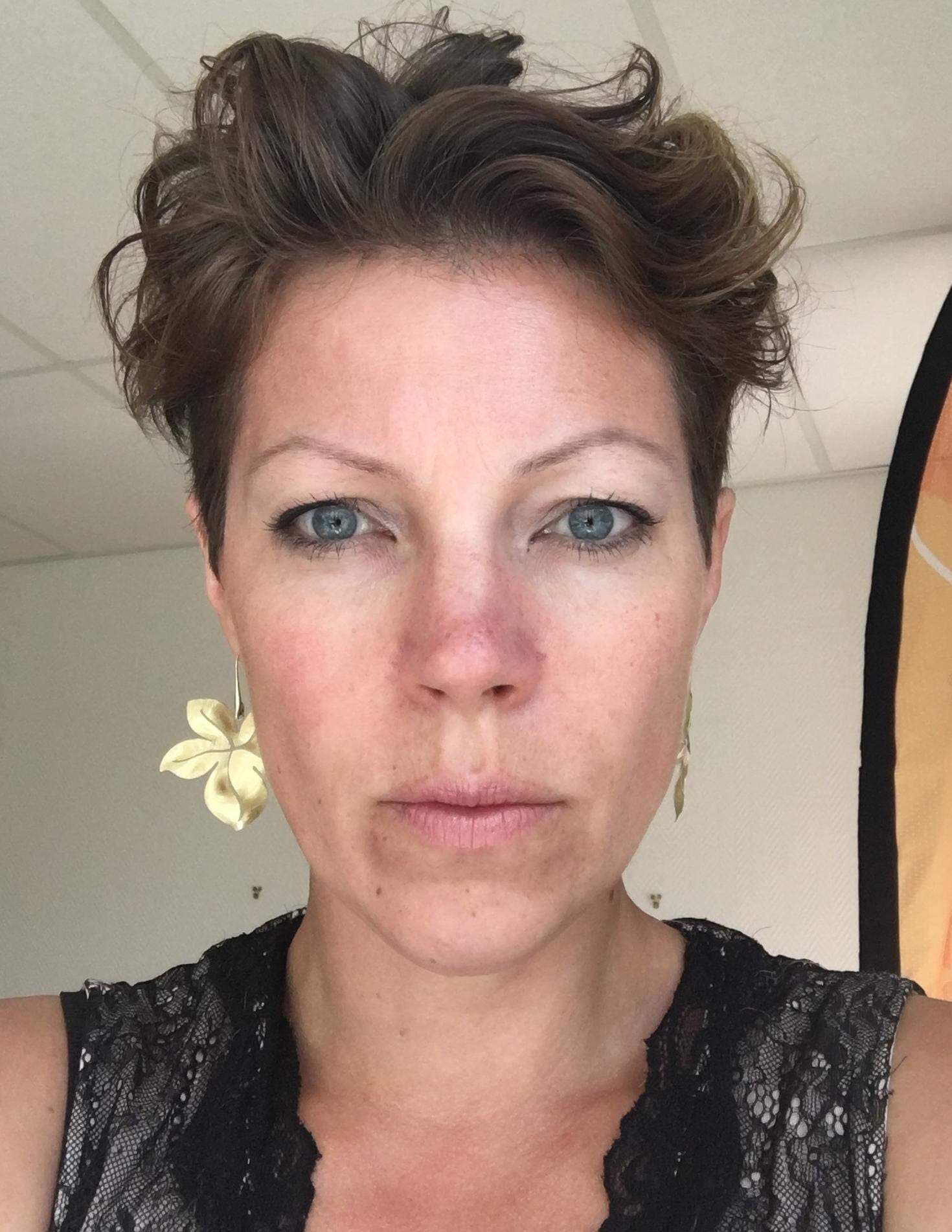 TB_måste roteras åt höger.jpeg